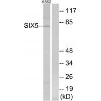 SIX5