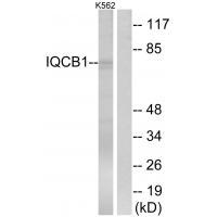 IQCB1
