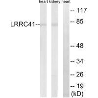 LRRC41