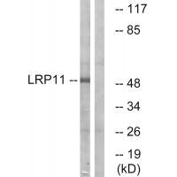 LRP11