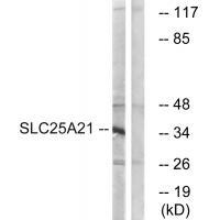 SLC25A21