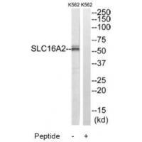 SLC16A2