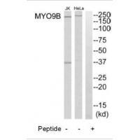 MYO9B