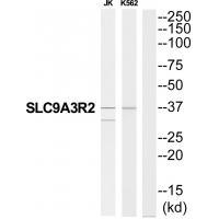 SLC9A3R2