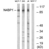 N4BP1