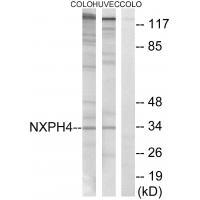 NXPH4
