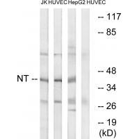NT
