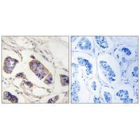 Rabbit Polyclonal Antibody to PEX7