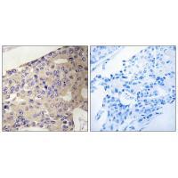 Rabbit Polyclonal Antibody to PEX1