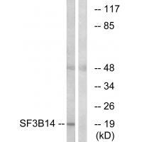 SF3B14