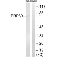 PRPF39