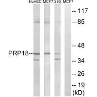 PRPF18