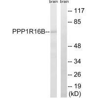 PPP1R16B