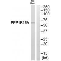 PPP1R16A