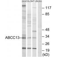 ABCC13