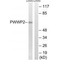 PWWP2B