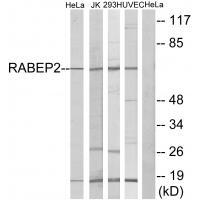 RABEP2