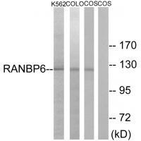 RANBP6