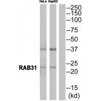 RAB31