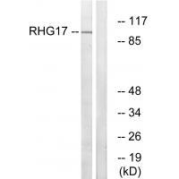 RHG17
