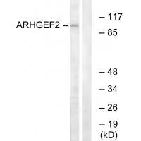 ARHGEF2