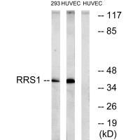 RRS1
