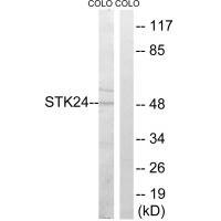 STK24