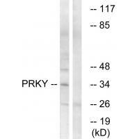 PRKY