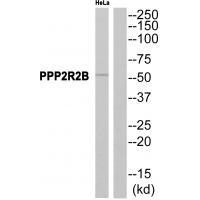 PPP2R2B