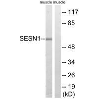 SESN1