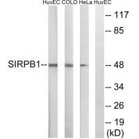 SIRPB1
