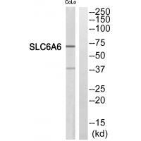 SC6A6