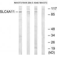 SLC4A11