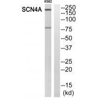 SCN4A