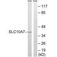 SLC10A7