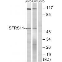 SFRS11