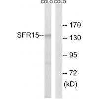 SFRS15