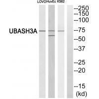 UBASH3A