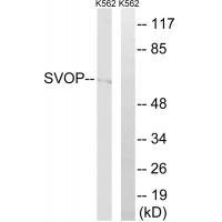 SVOP