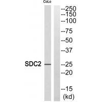 SDC2