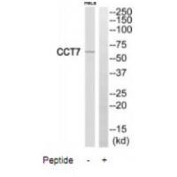CCT7