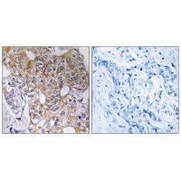 Rabbit Polyclonal Antibody to CCT6A