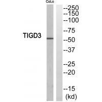 TIGD3