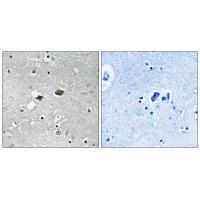 Rabbit Polyclonal Antibody to TIGD3