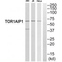 TOR1AIP1