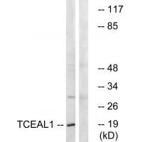 TCEAL1
