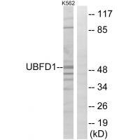 UBFD1