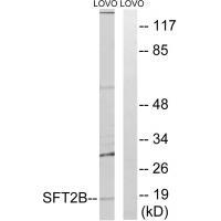 SFT2B