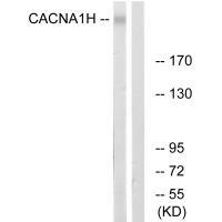 CACNA1H