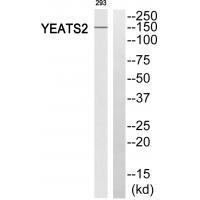 YEATS2